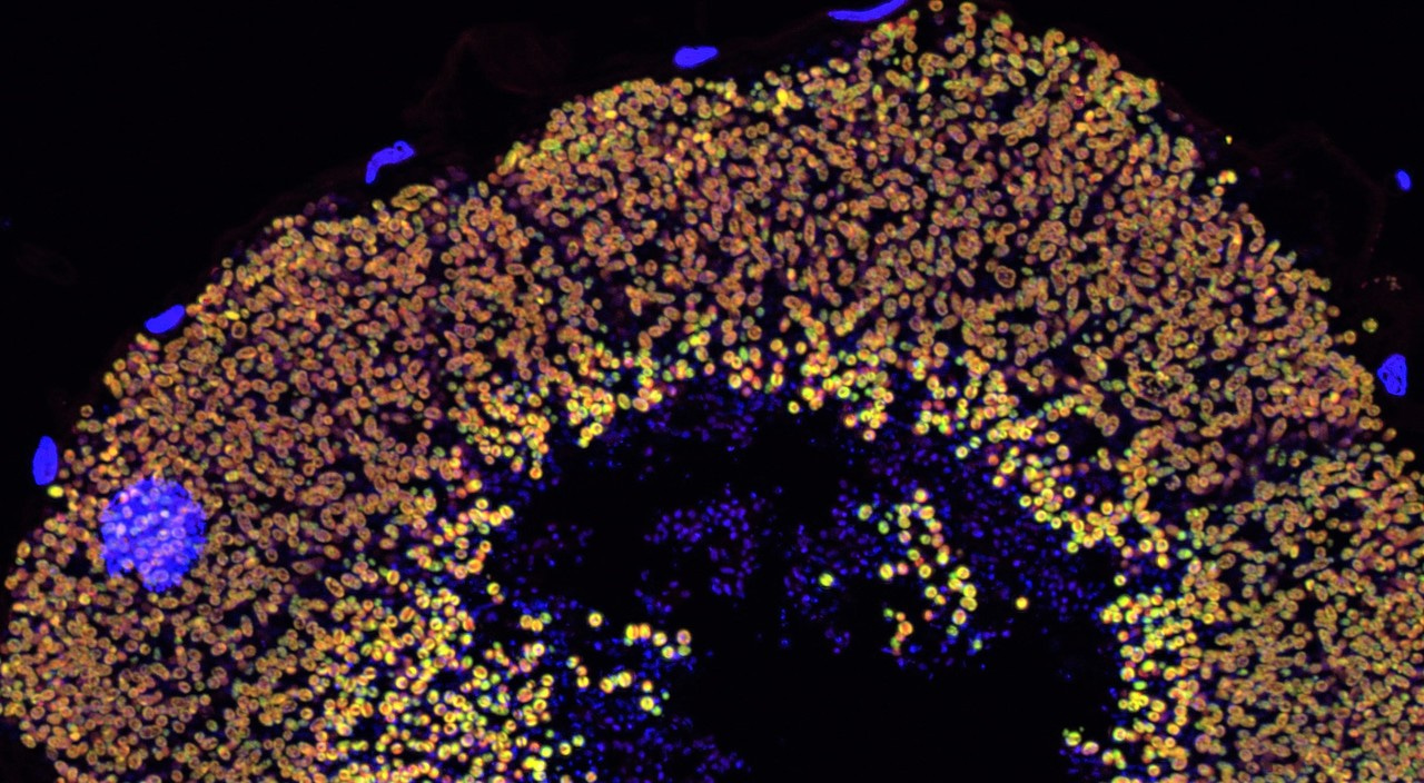 Double benefit: bacterial symbionts upgrade the specialized diets of reed beetle larvae and adults