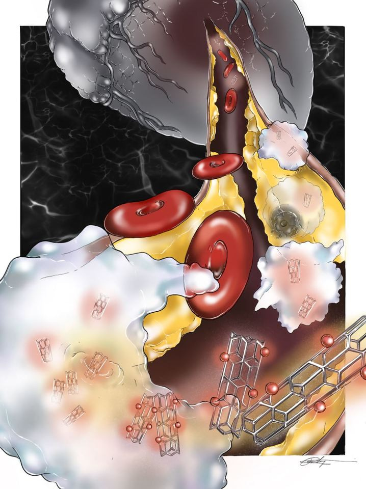 Trojan horse nanoparticles as a platform for the prevention of atherosclerotic cardiovascular disease. 