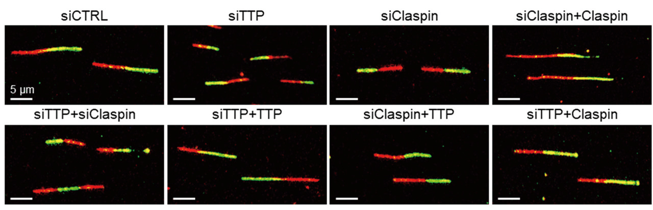 Posttranscriptional mechanism of replication stress response