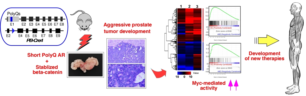 ANDROGEN RECEPTOR WITH SHORT POLYGLUTAMINE TRACT PREFERABLY ENHANCES WNT/BETA-CATENIN MEDIATED PROSTATIC TUMORIGENESIS
