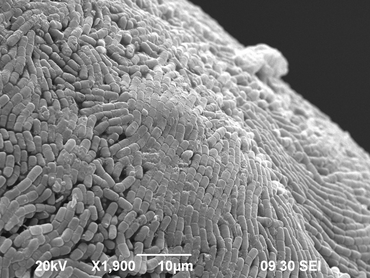 Decoding the Molecular Basis of Biofilm Formation