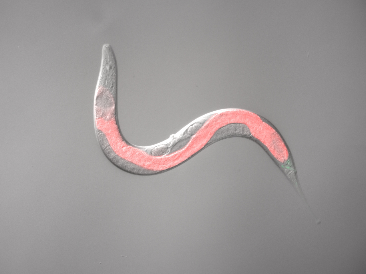 A few microns from the gut to the brain