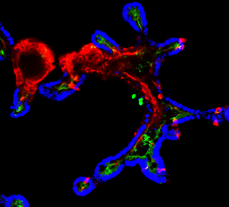 Metabolic control of Wnt signaling and colon tumorigenesis 
