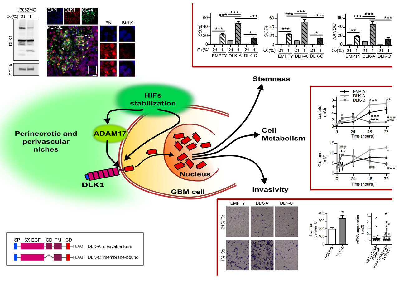 Hypoxia-induced release, nuclear translocation, and signaling activity of a DLK1 intracellular fragment in glioma