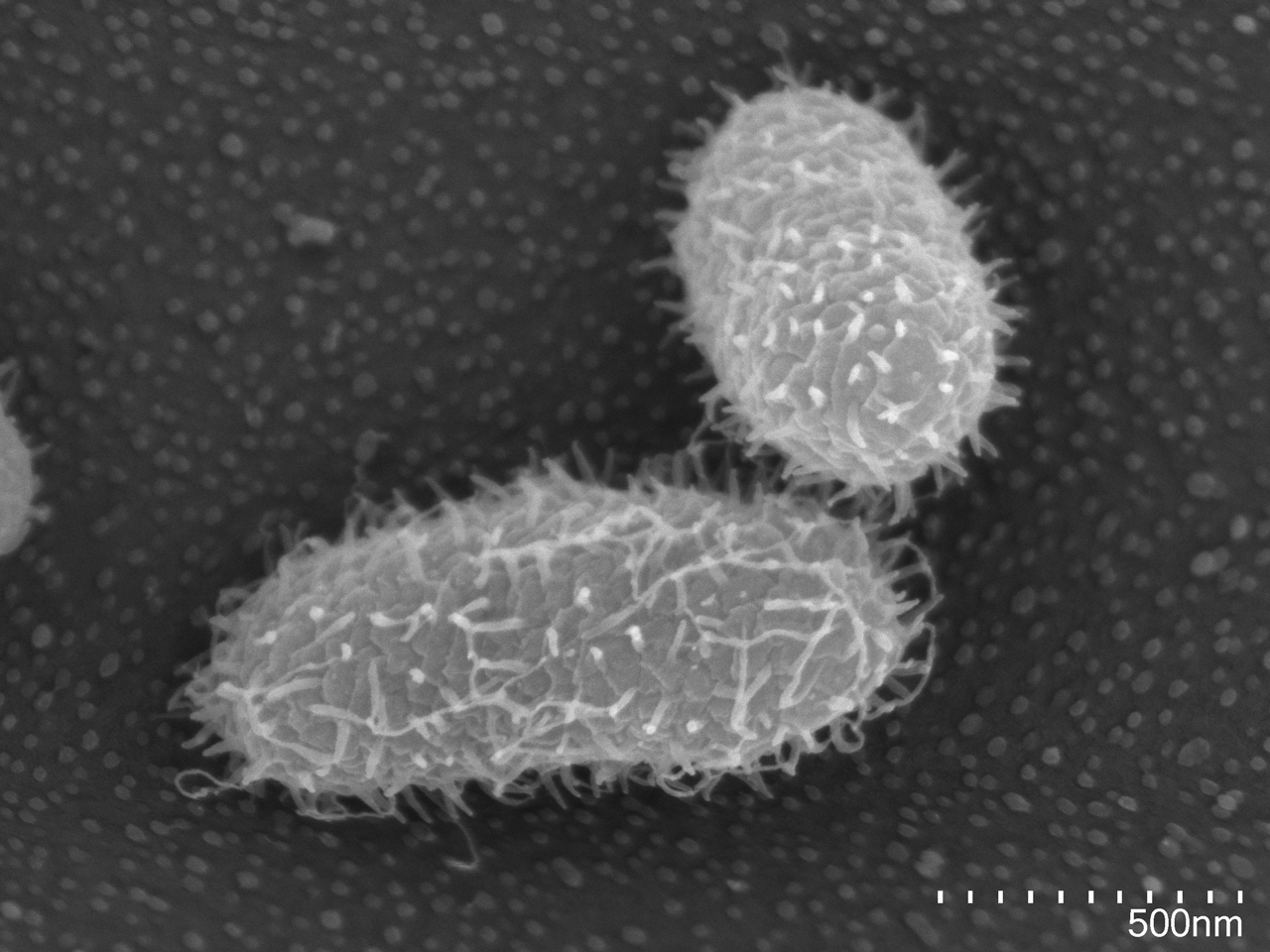 Your gut Bacteroides provision you with sphingolipids 