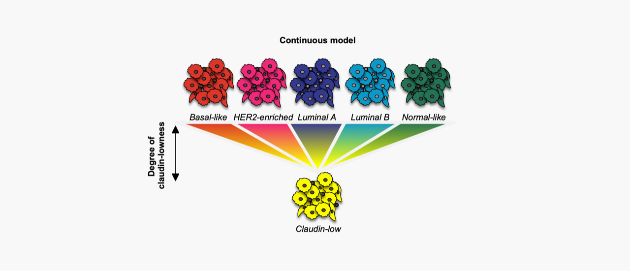 Claudin-low – truly an intrinsic breast cancer subtype?