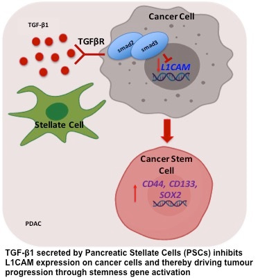 L1CAM acts as a tumour suppressor in pancreatic cancer