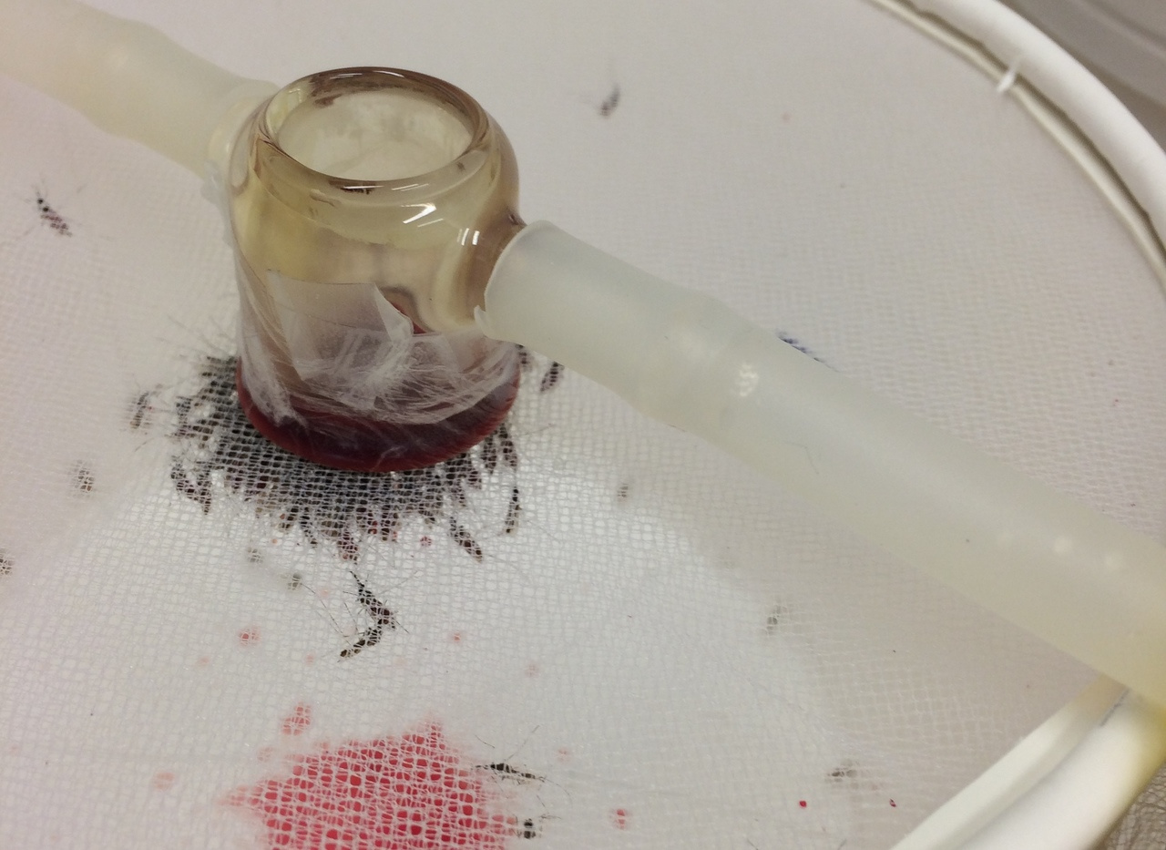 Whether you’re breakfast or dinner for a mosquito changes malaria transmission 