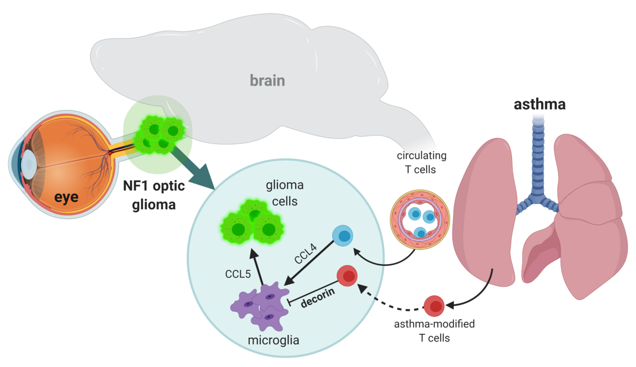 Determining why children with asthma have a lower incidence of brain tumors