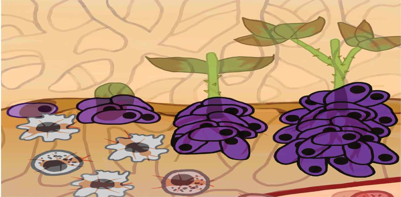 Early precursors of Multiple Myeloma display signs of immune compromise