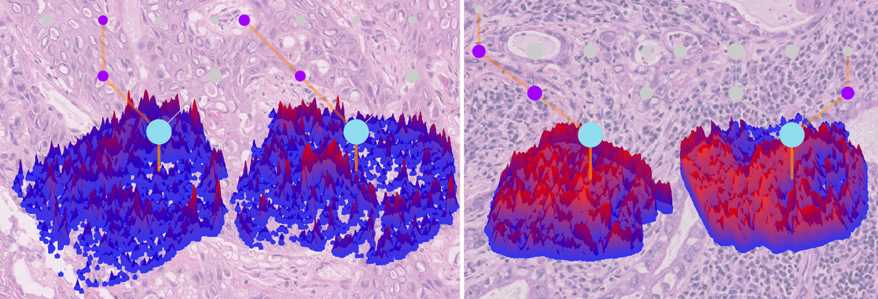 AI, histology and cancer evolution 