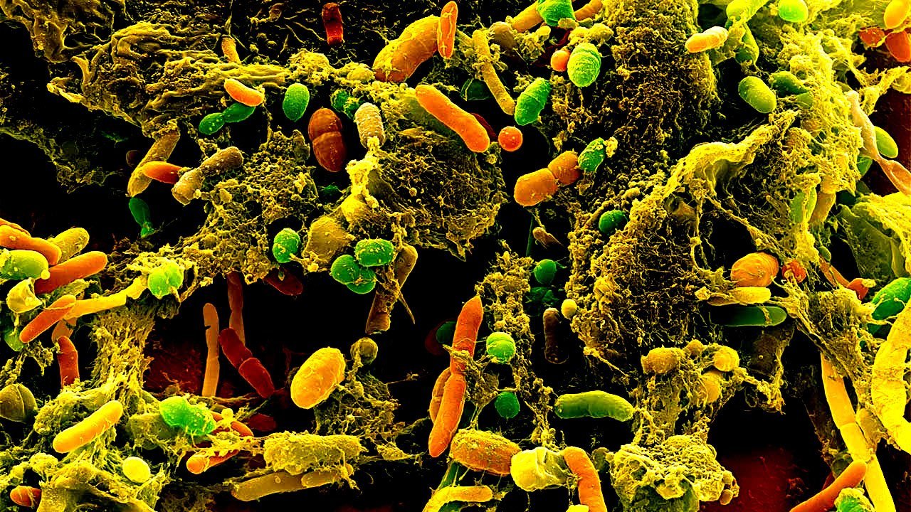 Gut fungi: true gut dwellers and host immune modulators