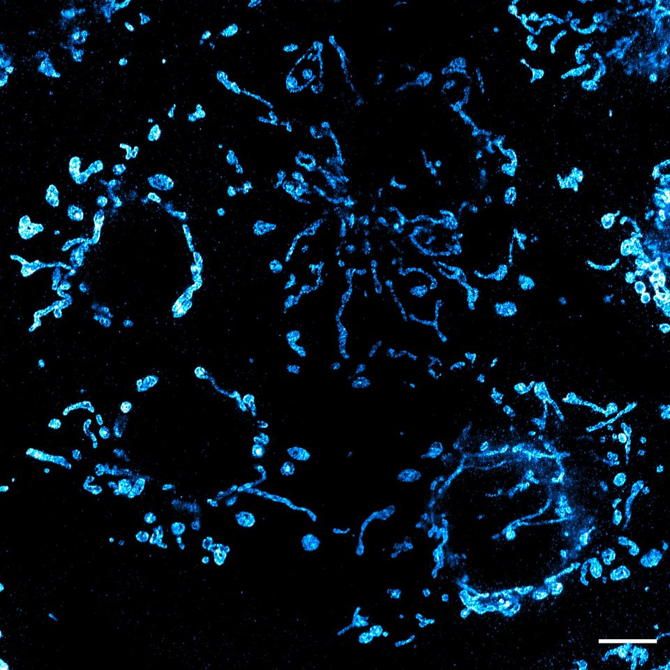 Multi-focal flat illumination for field-independent imaging