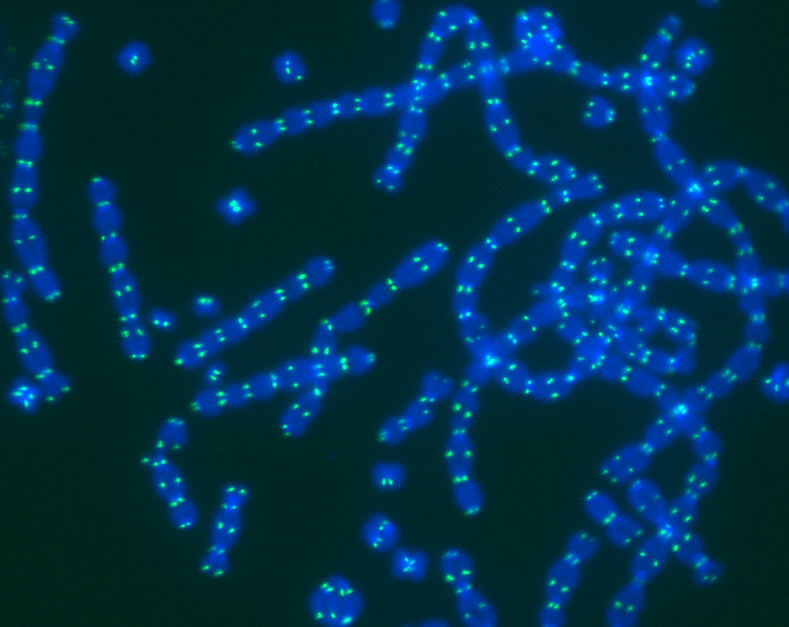 The multiple myeloma associated methyltransferase MMSET promotes classical NHEJ at deprotected telomeres

