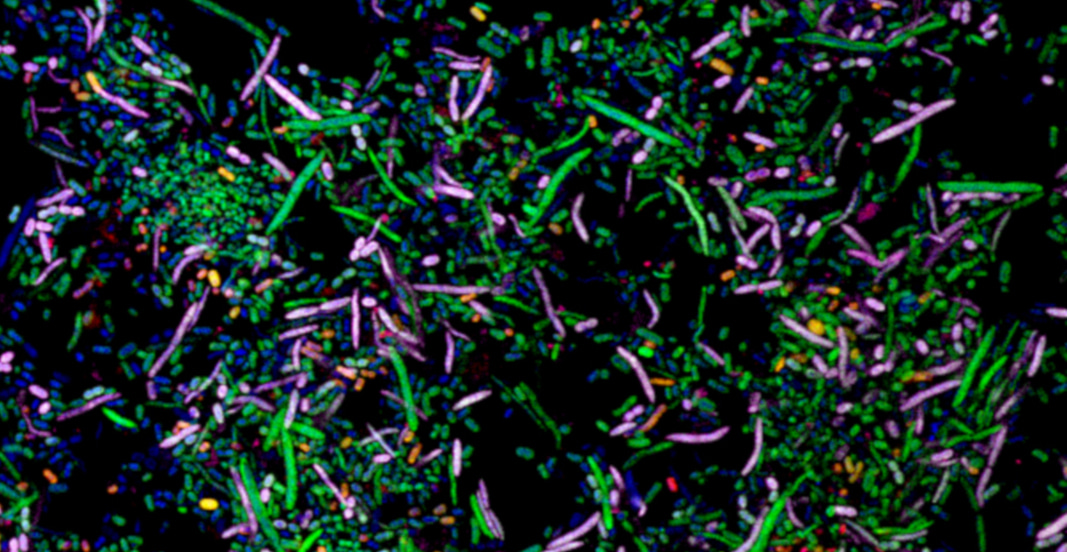 Reshaping the microbiome to fight C. difficile infections