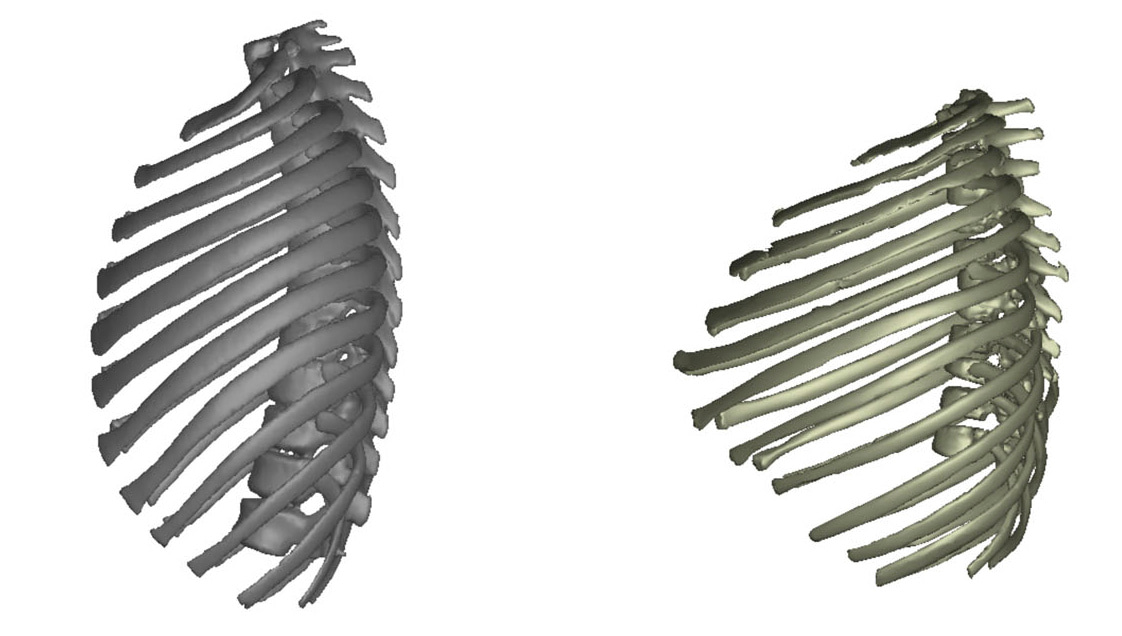 Reconstructing the thorax of the Turkana Boy