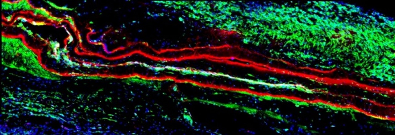 Pre-innervated Bioscaffolds To Repair Volumetric Muscle Loss