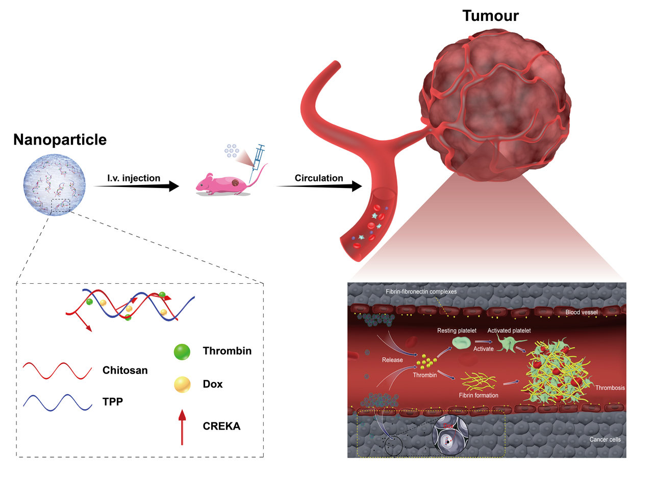 A new way for tumour chemoembolization