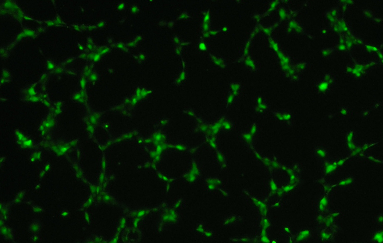Mdm2-mediated neddylation of pVHL blocks the induction of antiangiogenic factors
