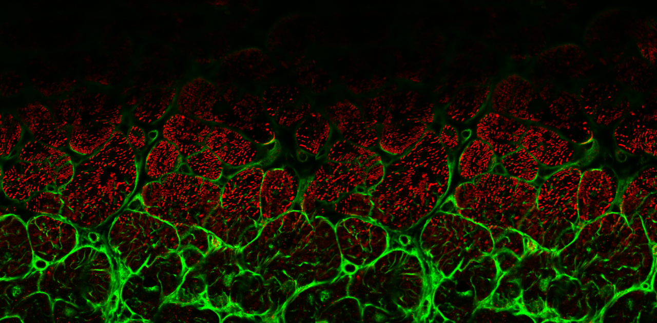 An integrative phosphoproteomic profiling strategy for mapping signalling perturbations in myocardial fibrosis
