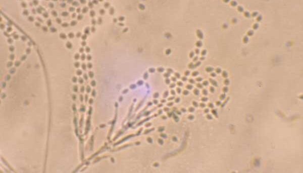 From the BugBitten Archives: Fungal compound inhibits transmission of malaria to mosquitoes