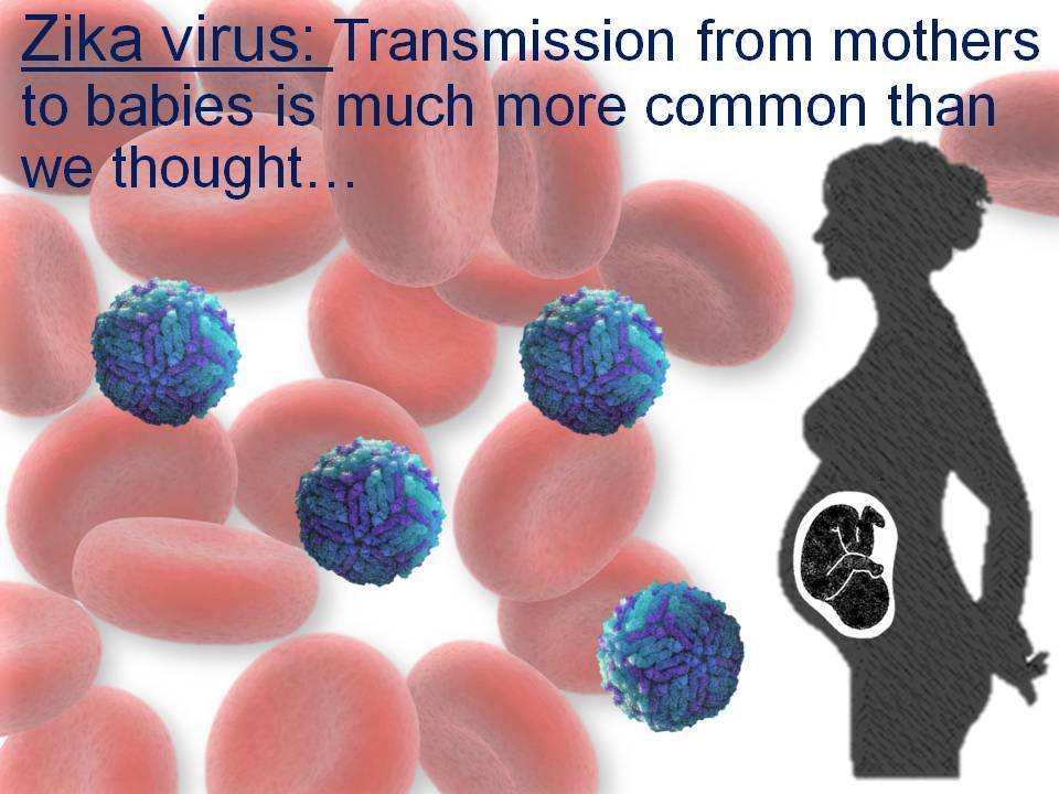 Zika virus: Transmission from mothers to babies is much more common than we thought…