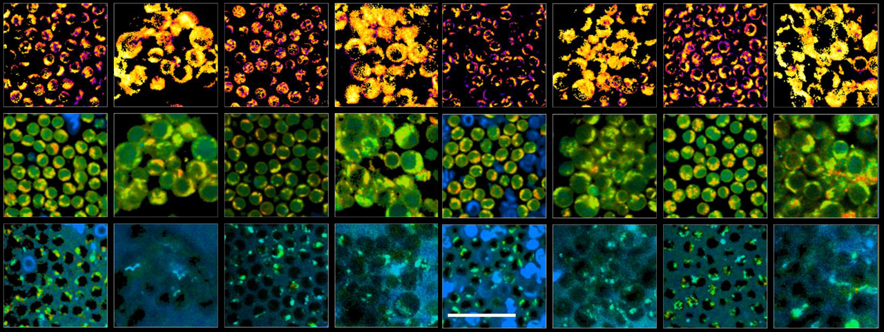 Label-free Imaging of T cell Activation