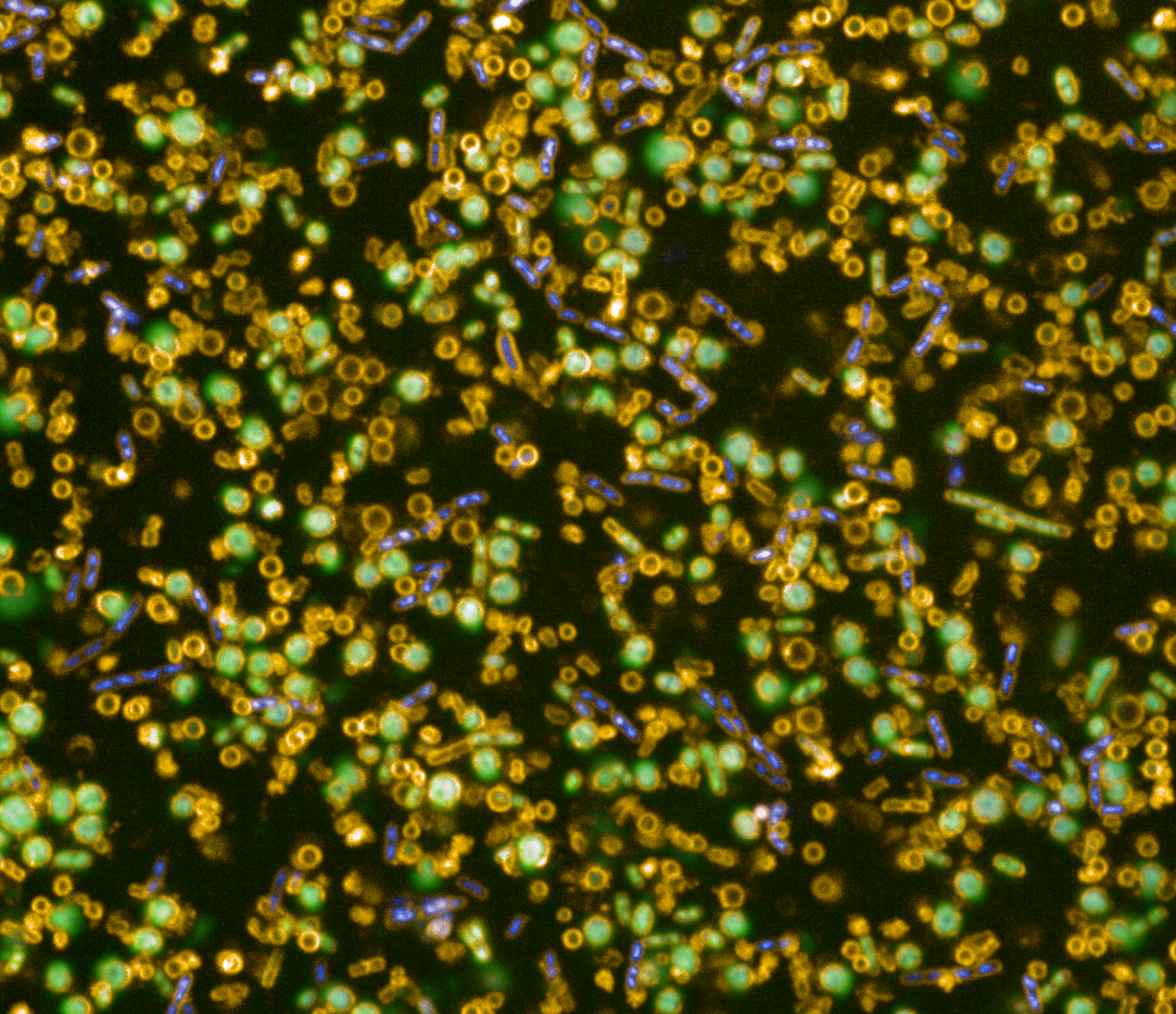 Linking bacterial antibody binding phenotypes to antibody function
