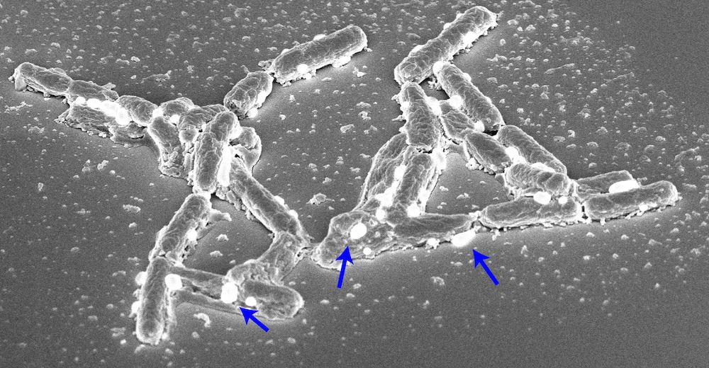 Histones partner up to kill bacteria