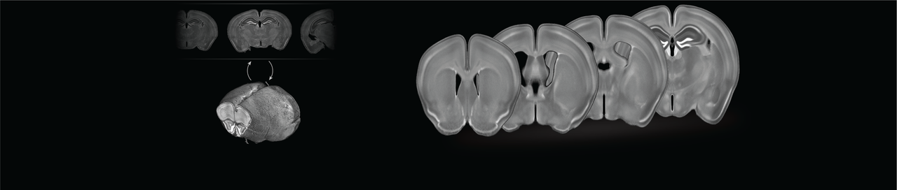 3D population-based average of mouse brain