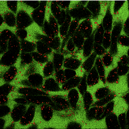 Femtosecond Plasmonic Laser Nanosurgery (fs-PLN) mediated by molecularly targeted gold nanospheres at ultra-low pulse fluences