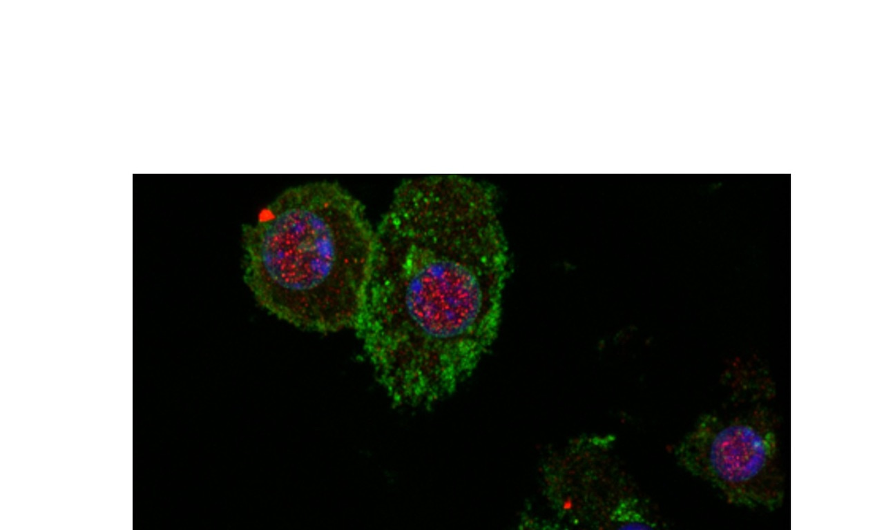 Investigating inflammasomes and cell death