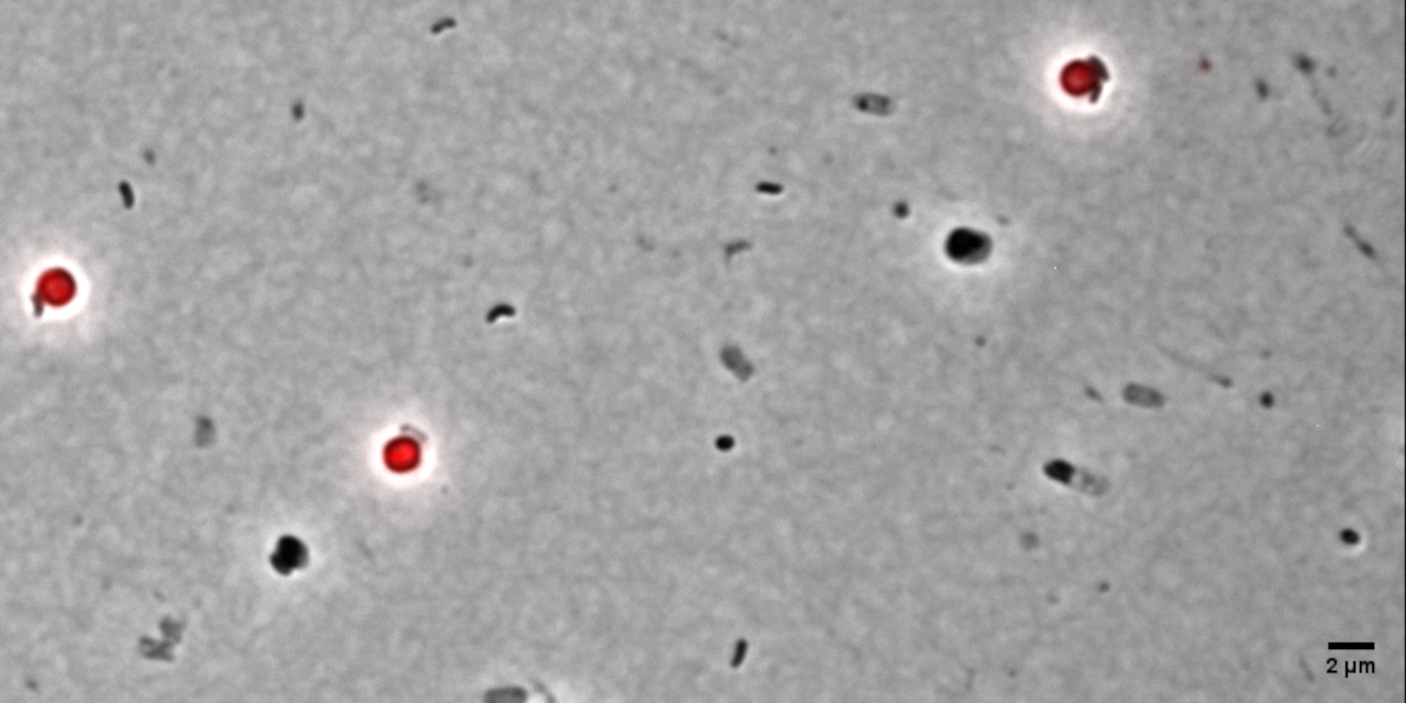 Protein abundance of a bacterial predator uncovers a bacteria-damaging enzyme