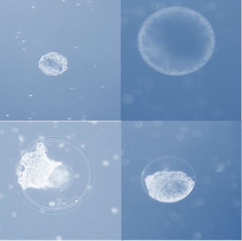 The promise of stemming cancer stem cells with miRNA modifiers 