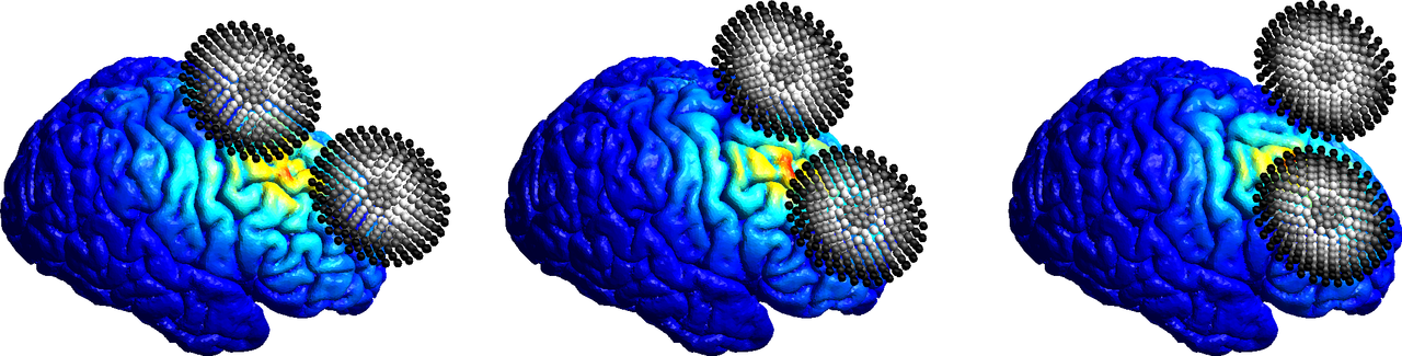Creating Individualized Targets for Transcranial Magnetic Stimulation (TMS)