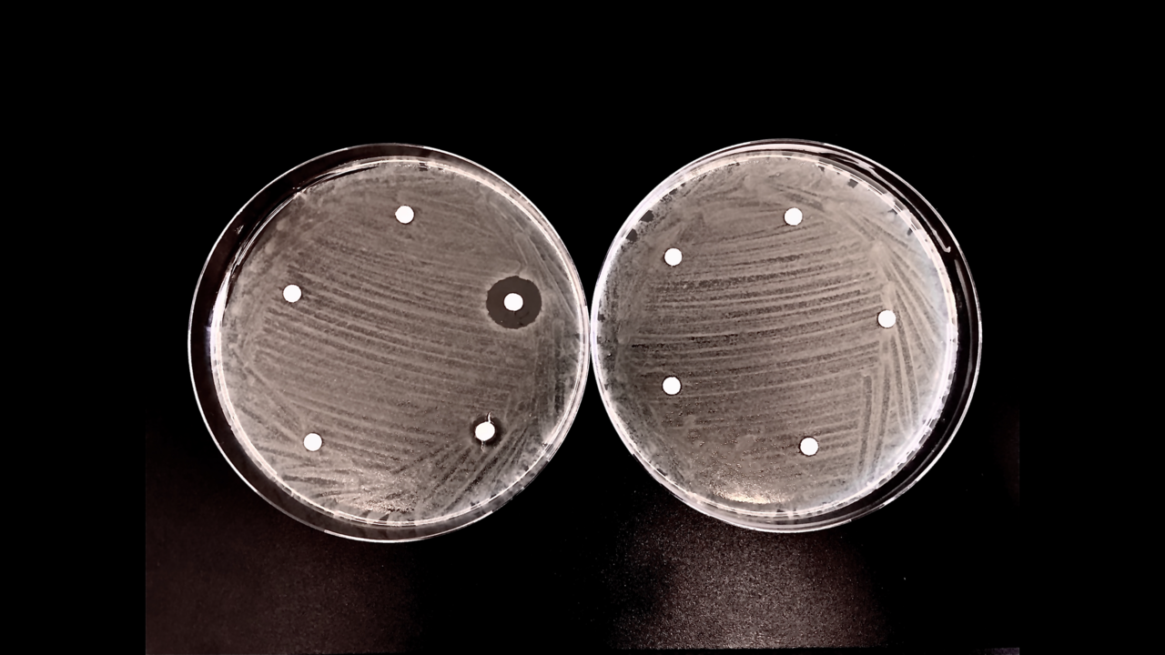 Marine environments harbor a large reservoir of antibiotic-degrading activities.