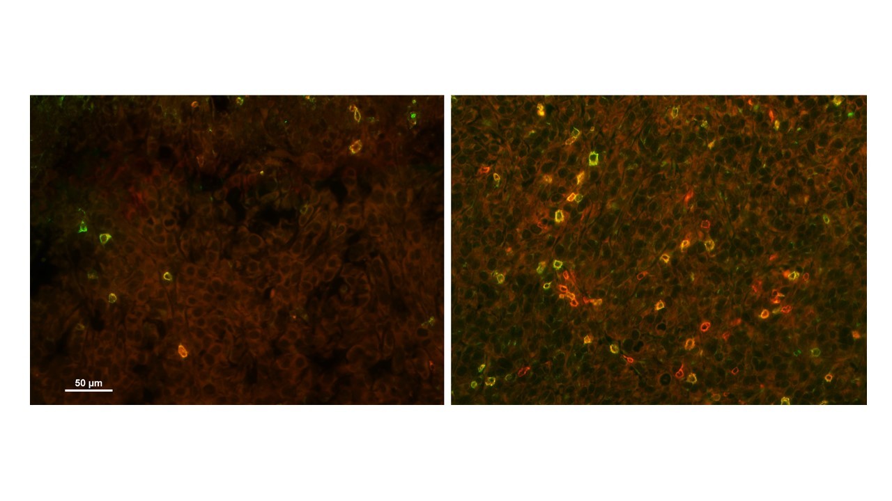 Targeting purine synthesis in ASS1 expressing tumors enhances the response to immune checkpoint inhibitors