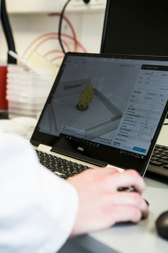 Tissue engineering for breast reconstruction