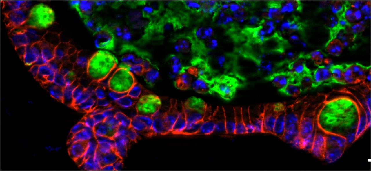 BRAFV600E drives dedifferentiation in small intestinal and colonic organoids and cooperates with mutant p53 and Apc loss in transformation