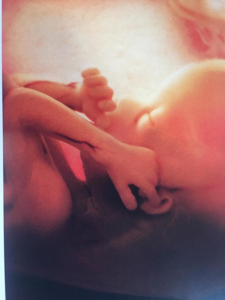 SARS-CoV-2 vertical transmission during pregnancy