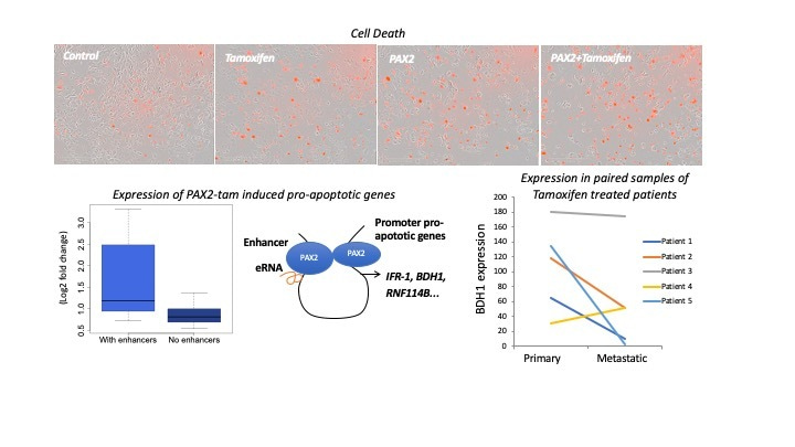 Tamoxifen and PAX2 stand as masters of death in breast cancer treatment