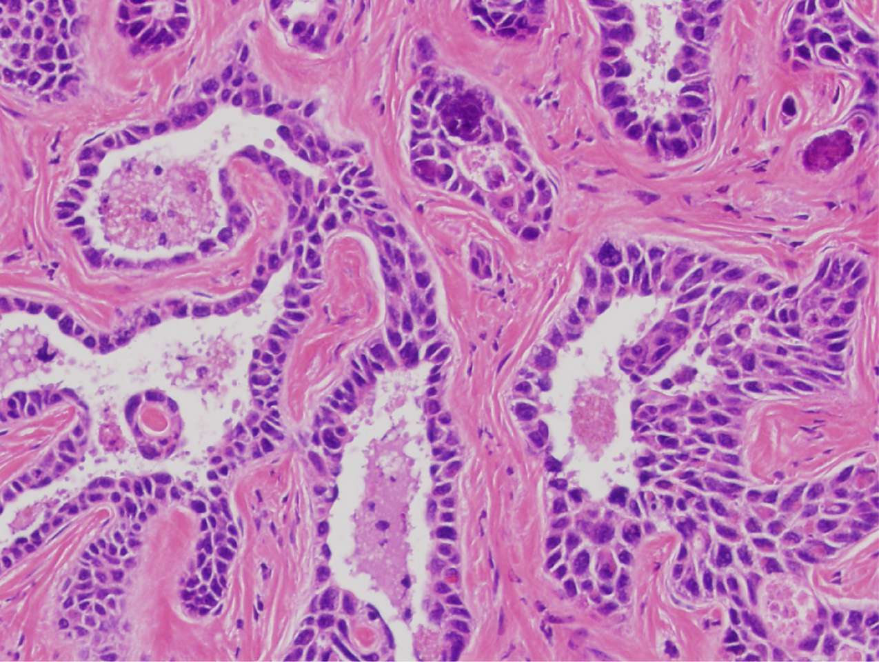 Behind the Paper: Dual ARID1A/ARID1B loss leads to rapid carcinogenesis and disruptive redistribution of BAF complexes