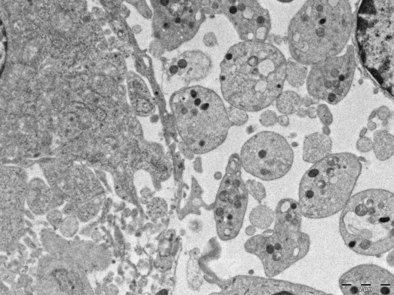 Calreticulin del52 and ins5 knock-in mice recapitulate different myeloproliferative phenotypes observed in patients with MPN