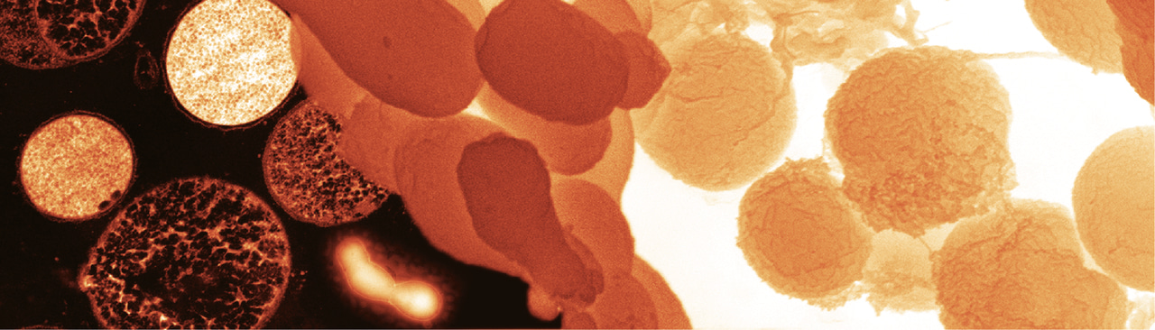 Back to the bench: the trials and tribulations of creating a public culture collection for the pig gut