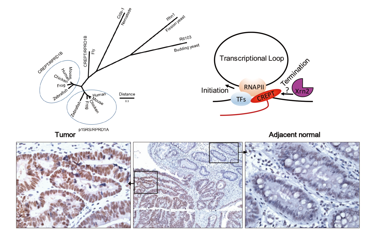 Current understanding of CREPT and p15RS, carboxy-terminal domain (CTD)-interacting proteins, in human cancers
