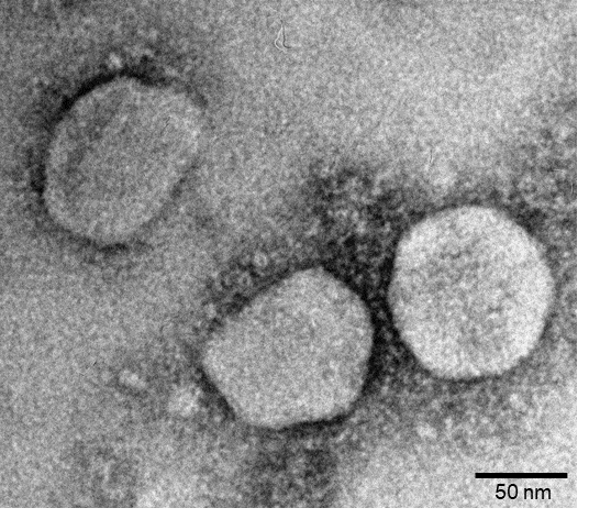 Potential of bat CoVs in the emergence of new CoV epidemics in human: a lesson from studying Ty-BatCoV HKU4
