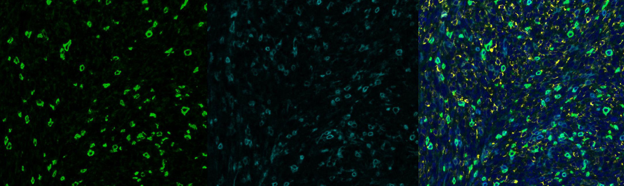 Models matter: Distinct immune landscapes in transplant and
primary tumors determine response or resistance to immunotherapy
