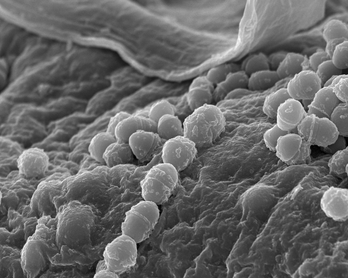 Brain infections: (no) flies on these ones.