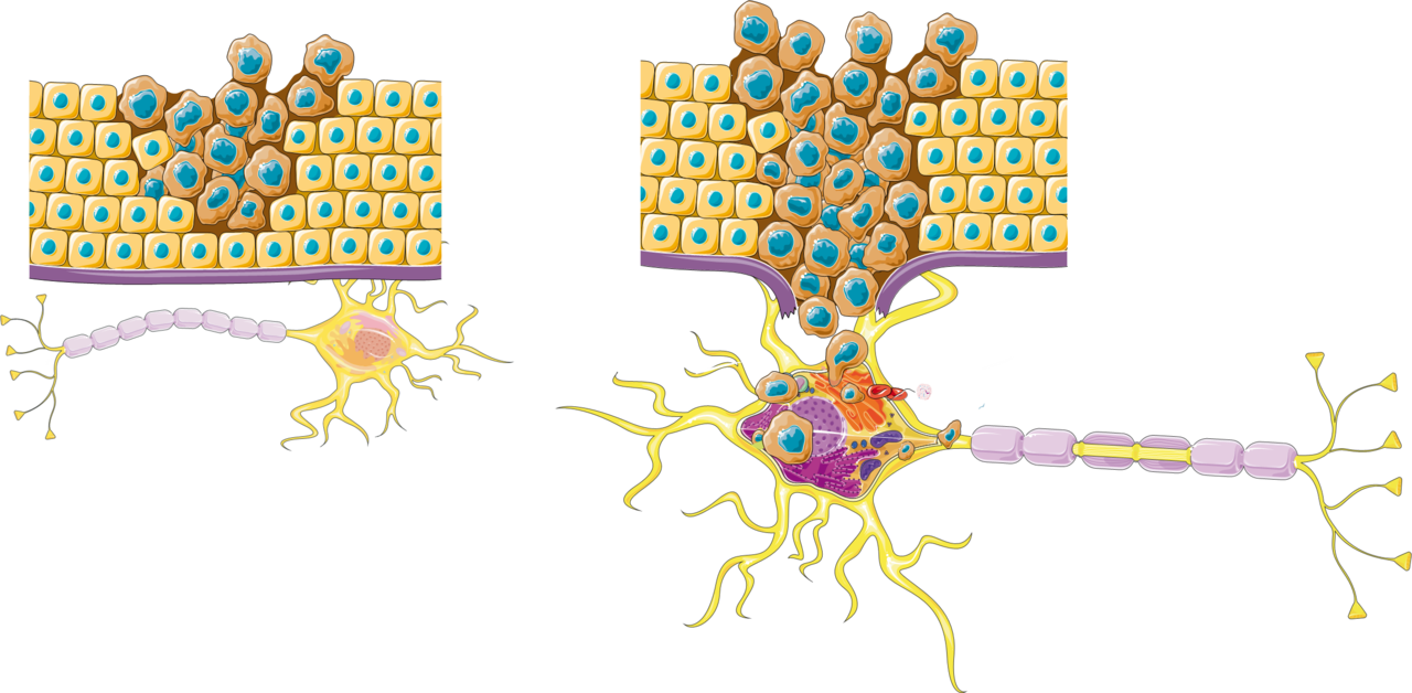 Nerve Fibres in the Tumour Microenvironment