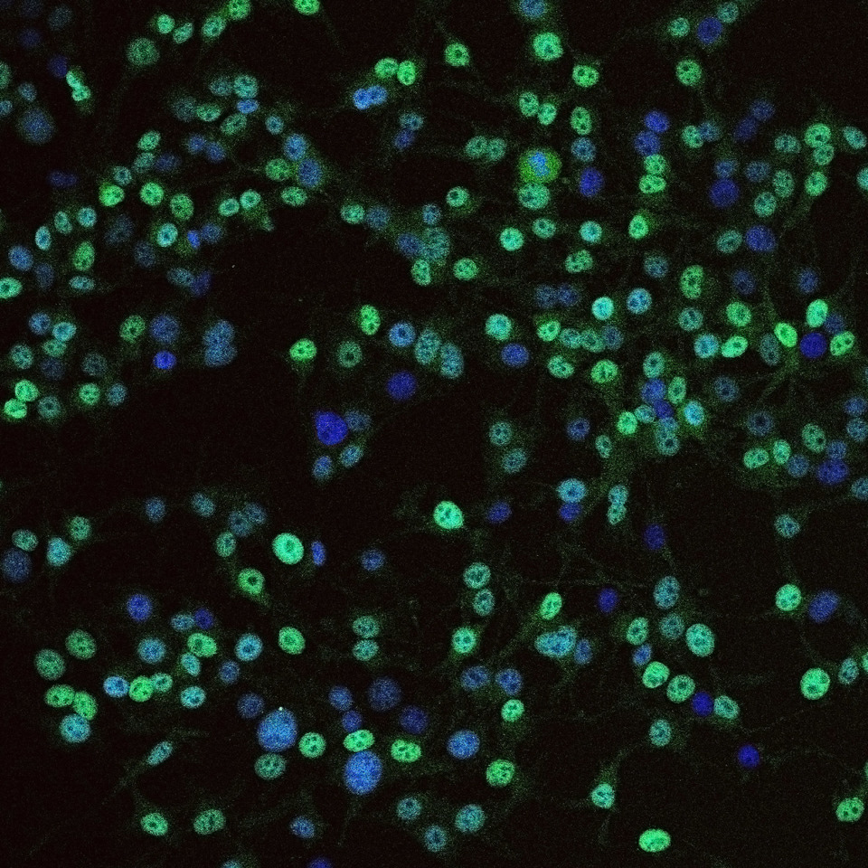 The YIN/YANG transcriptional interplay between melanoma invasion/proliferation is steered by the STAT3/MITF dualism
